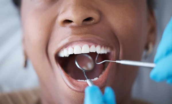 Chequeo Dientes Mujer Con Dentista Para Higiene Bucal Chequeo Cavidad — Foto de Stock