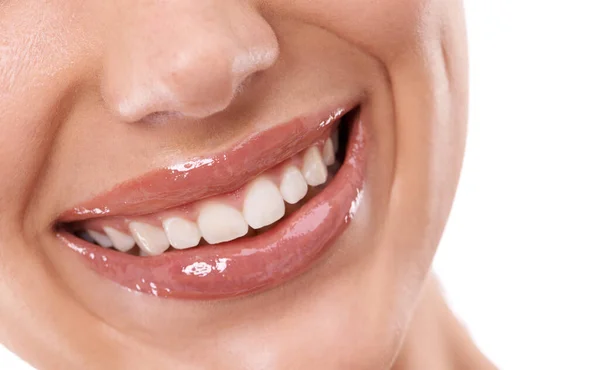 Sorriso Perfeito Uma Boca Mulher Dentes — Fotografia de Stock