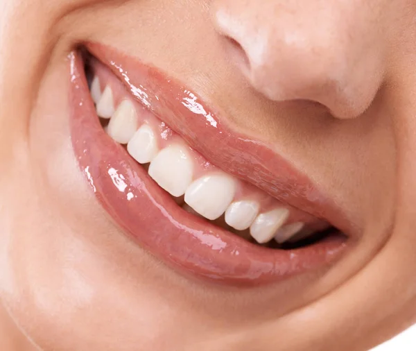 Itu Senyum Yang Sempurna Mulut Dan Gigi Wanita — Stok Foto
