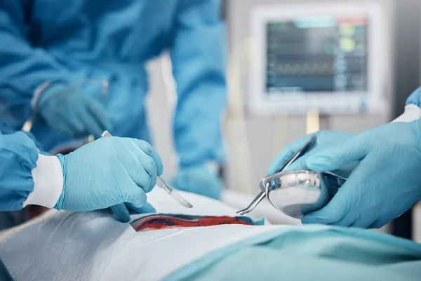 Mãos Sangue Operação Com Uma Equipe Médicos Trabalho Durante Cirurgia — Fotografia de Stock