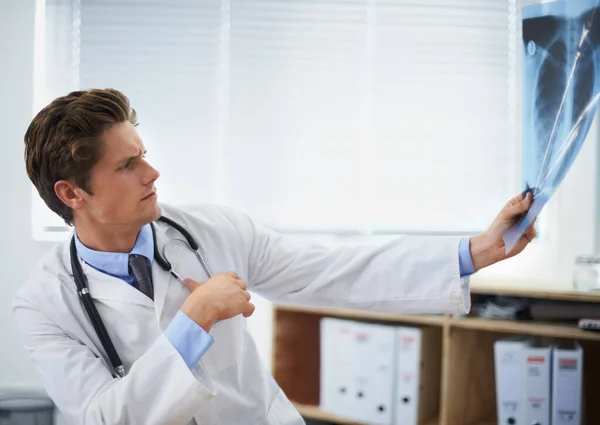 Letar Efter Tecken Sjukdom Oroad Ung Läkare Undersöker Lungröntgen — Stockfoto