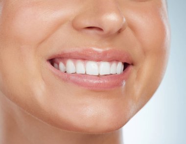 Closeup of unknown woman smiling with white teeth after a whitening treatment. Happy caucasian model isolated against grey background in a studio and showing perfect dental hygiene routine and care.