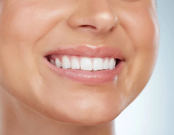 Closeup Unknown Woman Smiling White Teeth Whitening Treatment Happy Caucasian — Stock Photo, Image