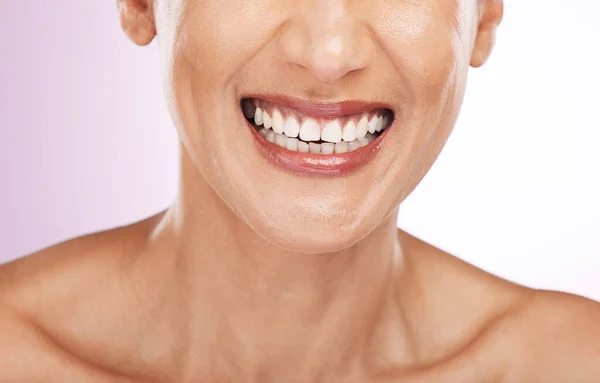 Viso Sorriso Denti Dentali Donna Con Faccette Sorridente Sbiancamento Dei — Foto Stock