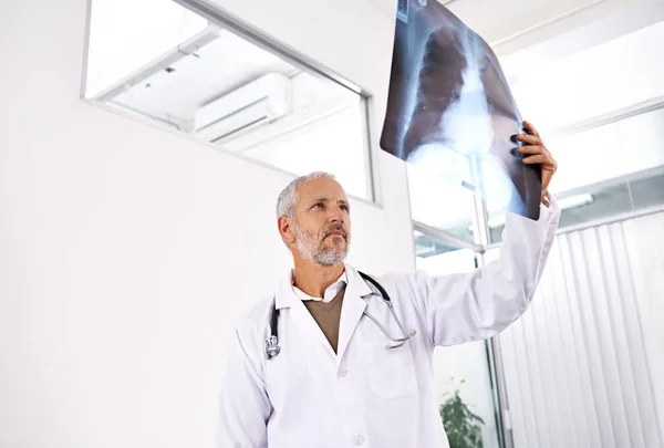 他专攻放射科 在医院检查X光影像的成熟男医生 — 图库照片