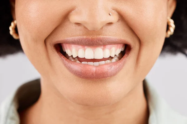 Úsměv Zubní Zuby Tvář Černošky Studiu Izolované Bílém Pozadí Péče — Stock fotografie
