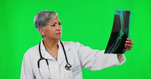 緑の画面と成熟した医師は 治療計画の結果を分析し スタジオの背景に隔離されています 女性の医療専門家の読書手術のためのMriスキャン — ストック動画