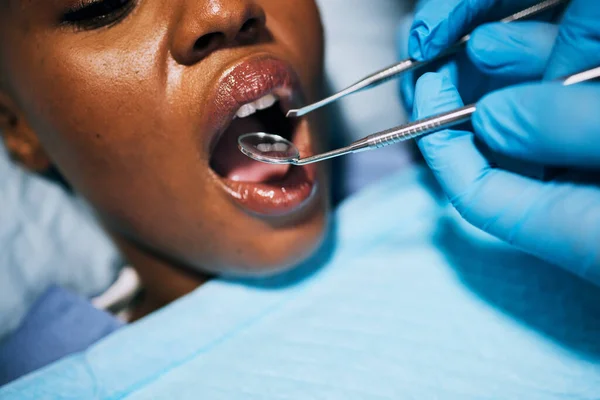 Ağız Kadın Dişçi Elleri Diş Temizliği Dişçiler Klinikte Ağız Temizliği — Stok fotoğraf