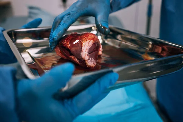 Chirurgia Szpitalna Lekarska Transplantacyjna Organów Sali Operacyjnej Użyciem Rąk Opieki — Zdjęcie stockowe