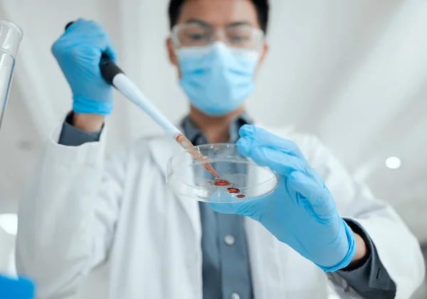 Potrzebujemy Twoich Darowizn Młody Naukowiec Wkładający Próbkę Szalki Petriego — Zdjęcie stockowe