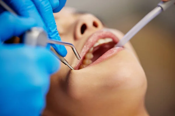 Come Sono Fatti Denti Sani Una Giovane Donna Sottoposta Una — Foto Stock