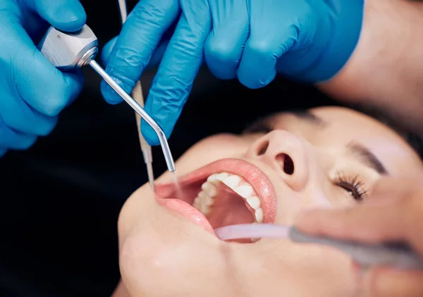 Lugar Feliz Una Mujer Limpiándose Los Dientes Por Dentista — Foto de Stock