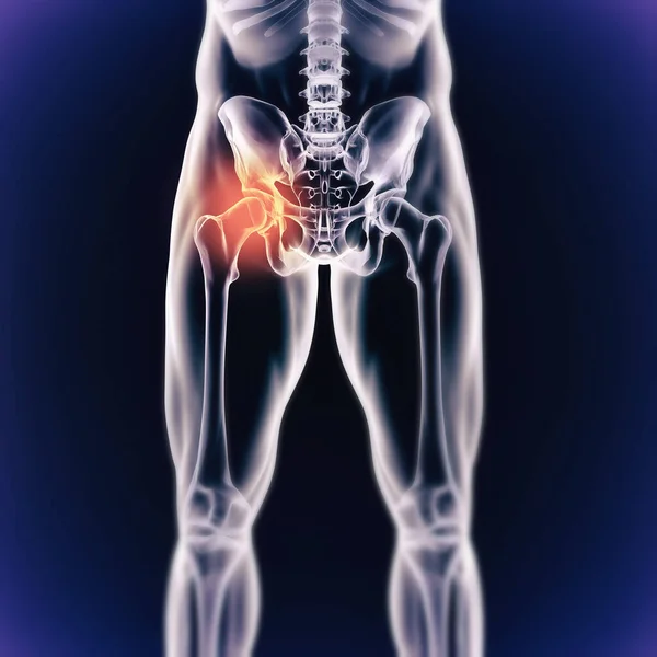 Kalça Ağrısı Kanaması Cgi Vücut Yapısı Olan Birinin Anatomi Röntgeni — Stok fotoğraf