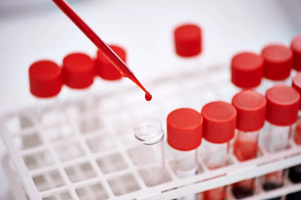 Your Blood Tells Story Closeup Shot Scientist Working Blood Samples — Stock Photo, Image