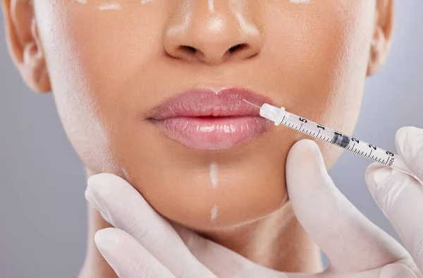 Bijhouden Van Trends Een Onherkenbare Vrouw Krijgt Lip Filler Injecties — Stockfoto