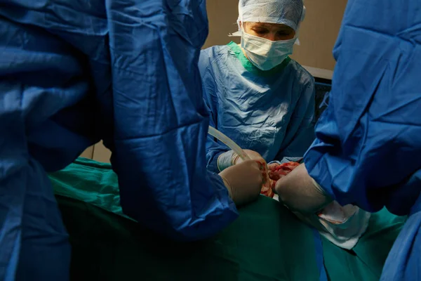 团队精神是手术成功的关键 在手术室里做手术的一组外科医生 — 图库照片