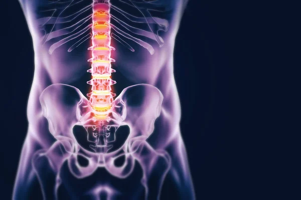 Omurga Anatomi Röntgen Stüdyoda Kemik Hastalığının Teşhisini Koyacak Karanlık Bir — Stok fotoğraf
