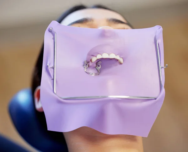 Нибудь Young Woman Having Dental Work Her Teeth — стоковое фото