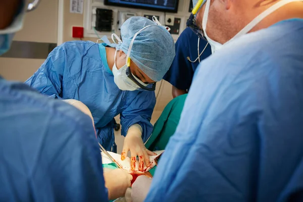 专注于复杂的外科手术过程 在手术室里做手术的一组外科医生 — 图库照片