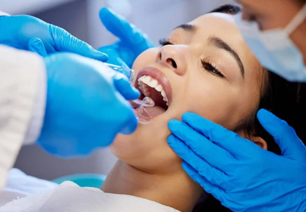 São Uns Dentes Saudáveis Uma Jovem Mulher Fazendo Procedimento Odontológico — Fotografia de Stock