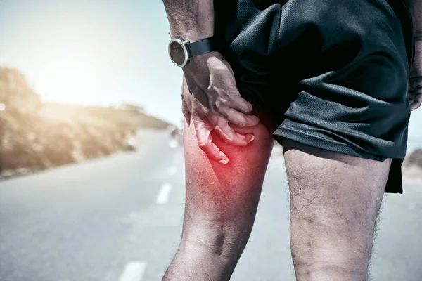 脚镣和受伤 一名运动员在室外锻炼时疼痛地握住自己的肌肉 男子运动员在训练时感到疼痛的运动 解剖和意外事故 — 图库照片