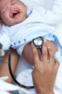 Stetoskop, yarık damak ve tıbbi muayenede bebek ve yeni doğan bir hastane veya klinikte ağlama. Doktor, çocuk doktoru ve çocuk kardiyoloji sınavına girsin ya da sağlık kontrolü yaptırsın..