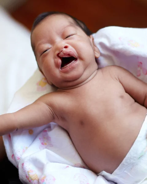 Cleft Lip Baby Kind Geboorte Met Een Portret Van Een — Stockfoto