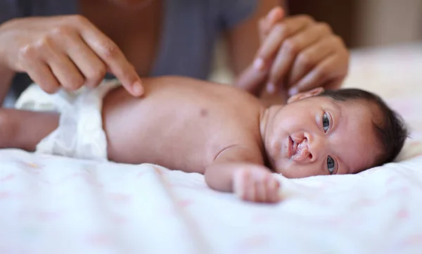 Pflege Porträt Und Ein Baby Mit Gaumenspalte Das Umgezogen Wird — Stockfoto