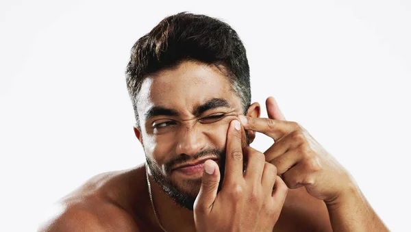 にきびのためのスキンケアとウェルネスルーチンを行うシンプルなポップ インドの男と苦労モデル 皮膚科 皮膚の輝きとにきびのための顔の洗浄のための隔離された 白い背景と美しさの治療 — ストック写真