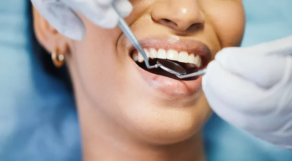 Dentista Espejo Manos Boca Del Paciente Herramientas Médicas Cirugía Salud —  Fotos de Stock