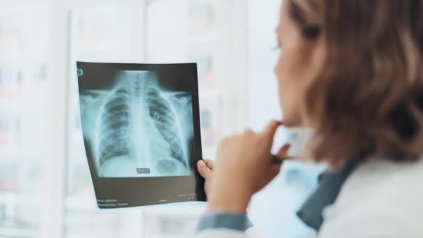 Röntgen Analyse Und Ärztin Denken Gesundheitsforschung Lösung Und Überprüfung Des — Stockvideo