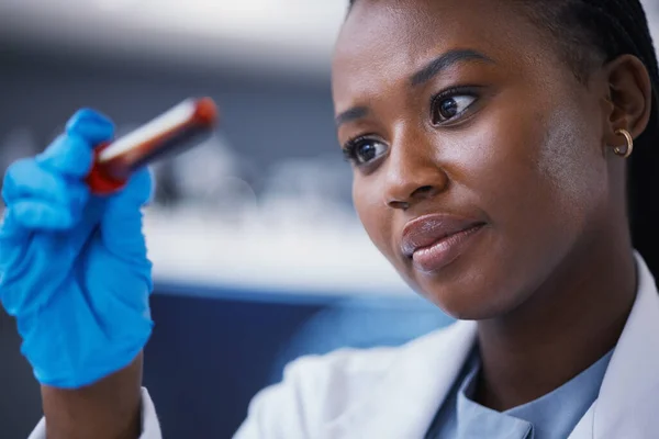 Wissenschaft Blutgefäß Und Wissenschaftlerin Einem Labor Das Einem Medizinischen Experiment — Stockfoto
