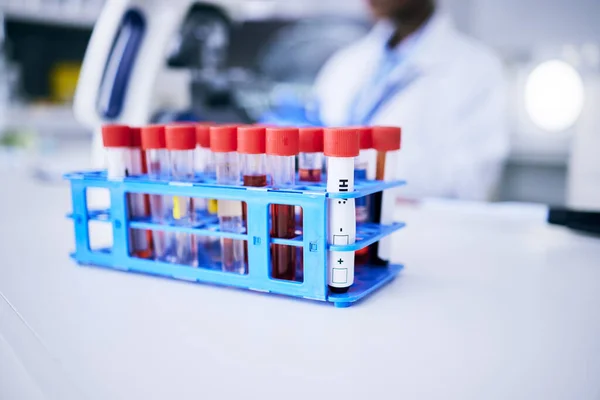 Medical Research Vials Blood Test Science Breakthrough Discovery Experiment Project — Stock Photo, Image