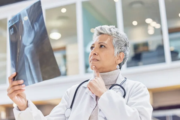 Mujer Médico Radiología Pensar Con Rayos Los Resultados Prueba Gráfico —  Fotos de Stock