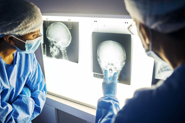 Skull x ray, screen and doctor with analysis of scan, healthcare and surgery with medical team and neurology. Radiology, assessment and plan with people in hospital, surgeon and medicine with anatomy.