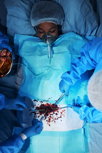 Narzędzia Chirurgiczne Pacjenta Medyczne Dłońmi Krwią Szpitalu Nagłe Wypadki Zespołem — Zdjęcie stockowe