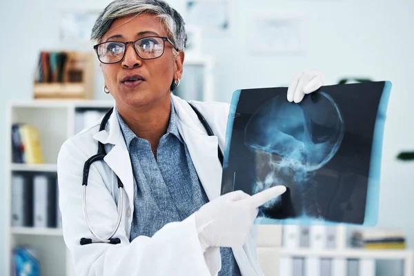 Krankenhaus Arzt Und Seniorin Mit Röntgenbild Für Die Operation Ärztliche — Stockfoto