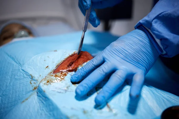 Krew Ręce Lub Lekarze Tnący Zabiegu Chirurgicznym Nagłym Wypadku Lub — Zdjęcie stockowe