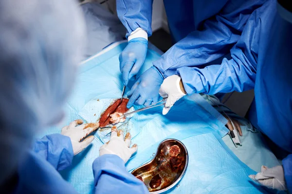 Emergência Mãos Cirurgiões Cortando Cirurgia Procedimento Operação Saúde Hospital Luvas — Fotografia de Stock
