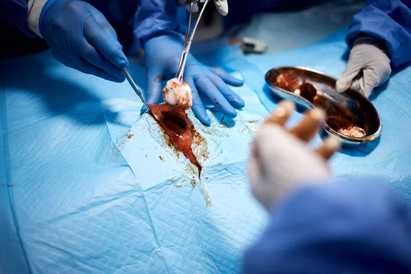 Sangue Mãos Cirurgiões Cortando Cirurgia Procedimento Emergência Operação Cuidados Saúde — Fotografia de Stock