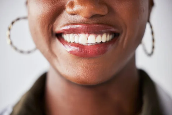 Sorriso Feliz Boca Closeup Mulher Negra Com Clareamento Dos Dentes — Fotografia de Stock