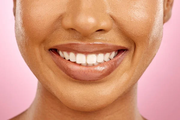 Mujer Boca Sonrisa Saludable Estudio Para Odontología Blanqueamiento Dientes Carillas — Foto de Stock
