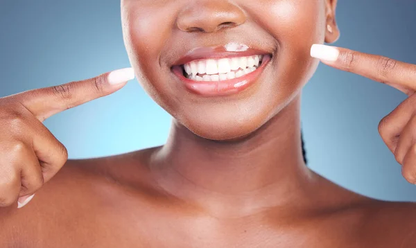 Glad Kvinna Tänder Och Pekar Tandrengöring Hygien Eller Behandling Mot — Stockfoto