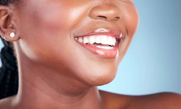 Kvinna Tänder Och Leende Tandrengöring Hygien Eller Behandling Mot Blå — Stockfoto