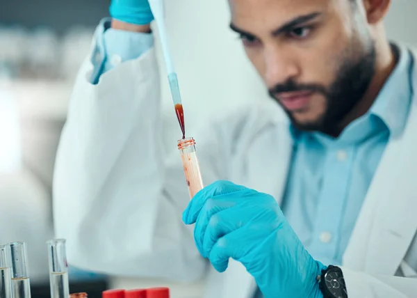 Nauka Człowiek Pipetą Krwią Probówce Wyniki Badań Laboratoryjnych Inżynieria Medyczna — Zdjęcie stockowe