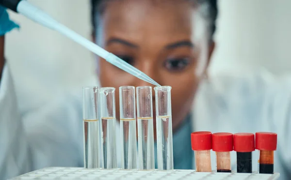 Nauka Kobieta Pipetą Krwią Probówce Badania Laboratoryjne Wyniki Inżynieria Medyczna — Zdjęcie stockowe