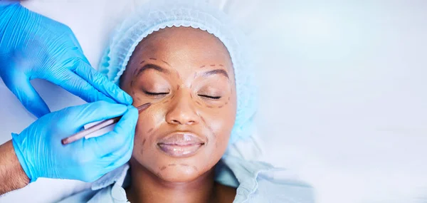 プラスチック手術 黒人女性は モックアップスペースのある皮膚科の病院のベッドで眠ります 医師と診療所でスキンケア 化粧品 健康のための外科医 フェイシャルチェンジ 医療用フィラー — ストック写真