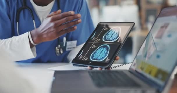 Médico Manos Tabletas Con Rayos Escáner Cerebral Reunión Discusión Planificación — Vídeo de stock