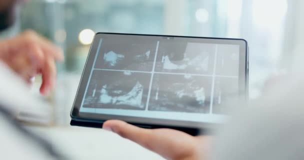 Médico Manos Tabletas Con Rayos Reunión Discusión Planificación Cirugía Juntos — Vídeo de stock