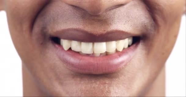 Zahn Lächeln Und Gesicht Des Mannes Nahaufnahme Für Zahnaufhellung Mundgesundheit — Stockvideo